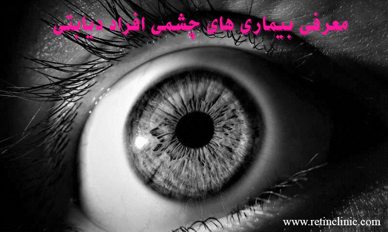 بیماری های چشمی افراد دیابتی