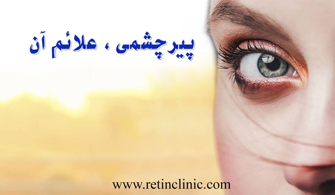 پیرچشمی