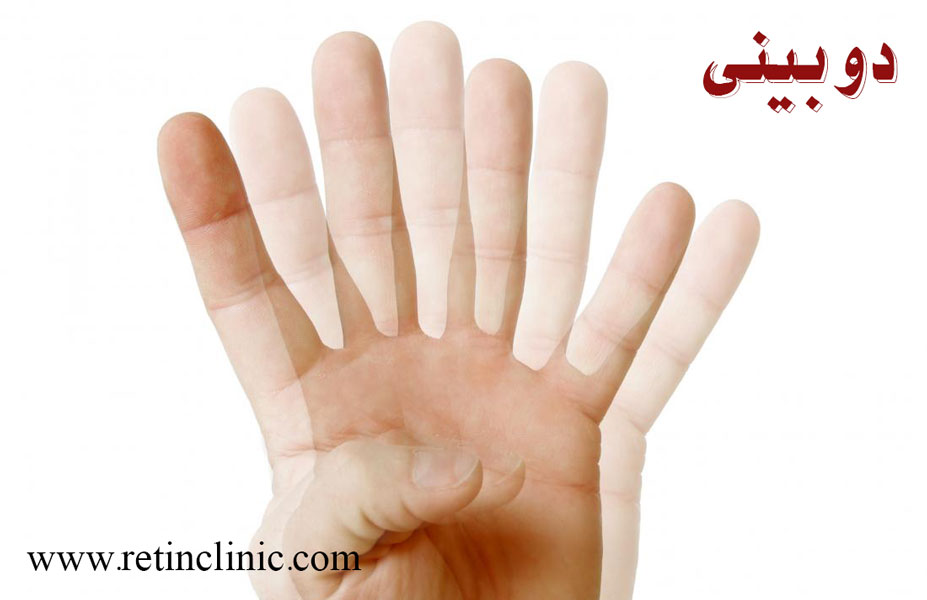 دوبینی