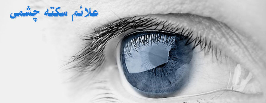 علائم سکته چشمی