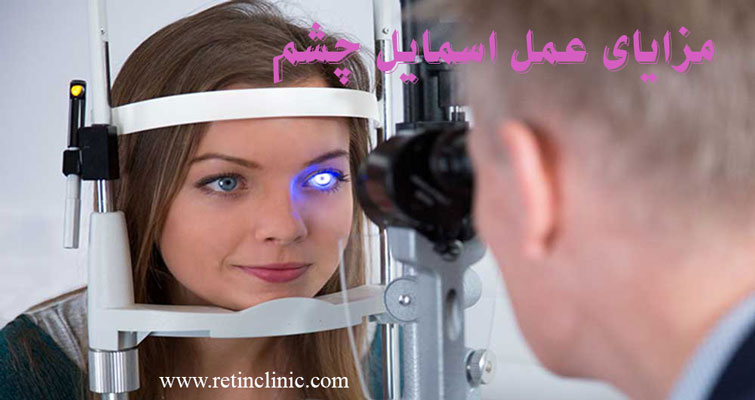 مزایای عمل اسمایل چشم