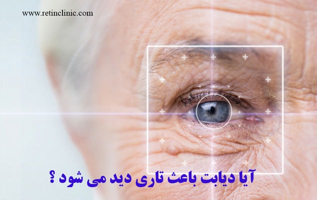 اثر دیابت بر تاری دید 