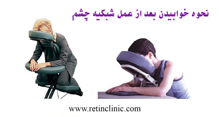 نحوه خوابیدن بعد از عمل شبکیه چشم