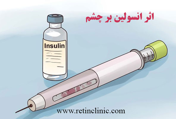 اثر انسولین بر چشم 