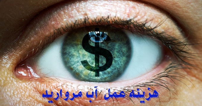 هزینه عمل آب مروارید