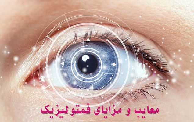 مزایای عمل فمتولیزیک