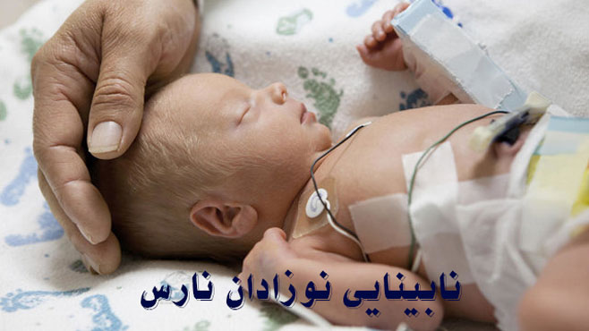 درمان نابینایی نوزادان نارس