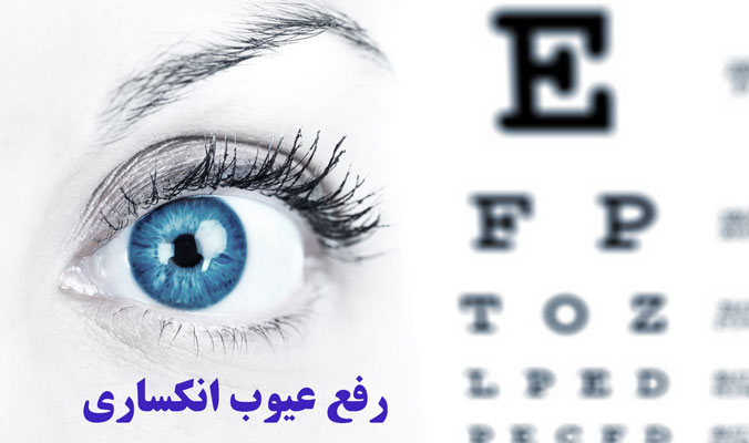 رفع عیوب انکساری