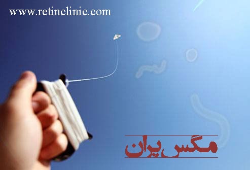 مگس پران