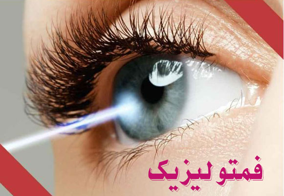 عمل فمتولیزیک