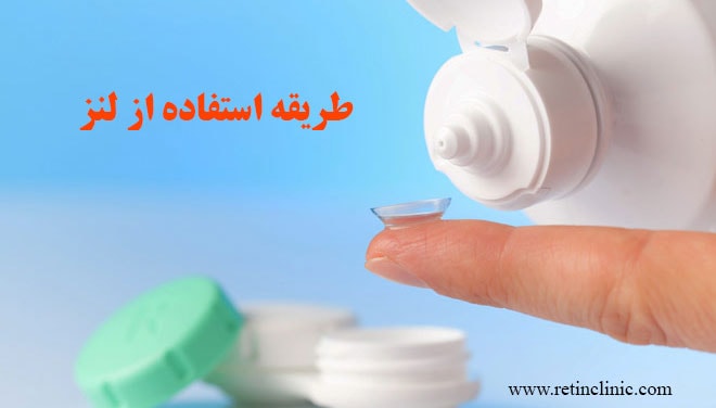 طریقه استفاده از لنز تماسی نرم