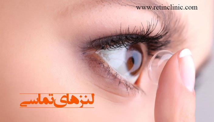 لنز های تماسی