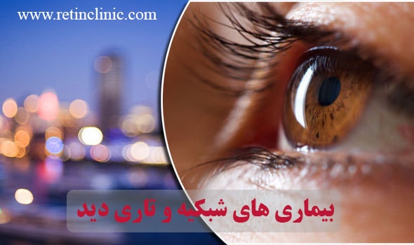 بیماری های شبکیه و تاری دید