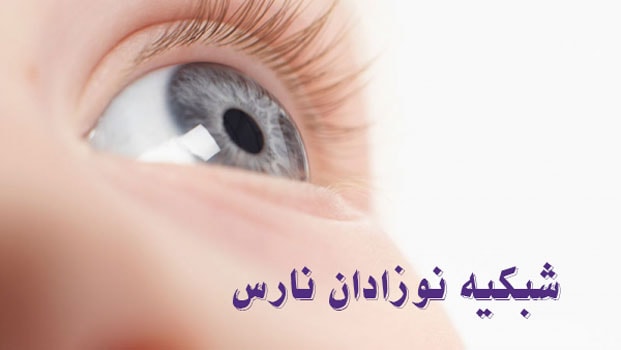 شبکیه نوزادان نارس
