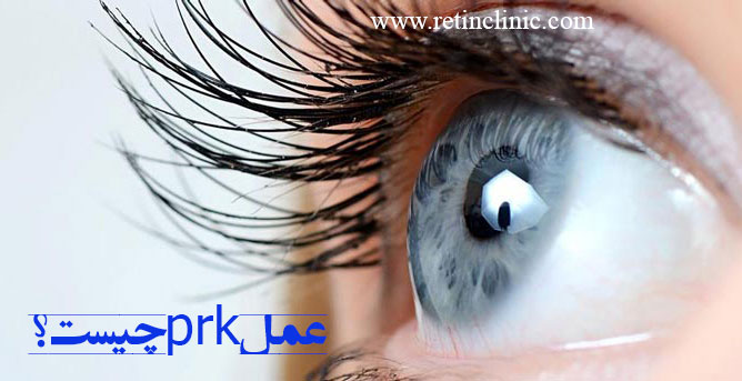 عمل prk چیست؟