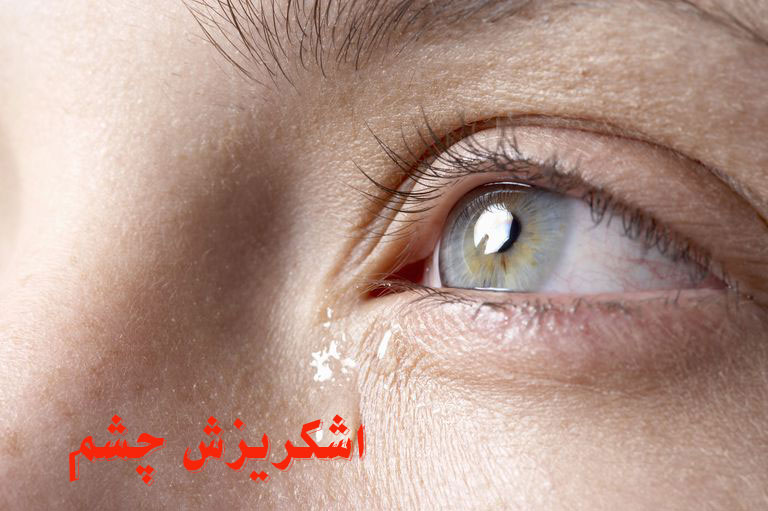 اشک ریزش چشم