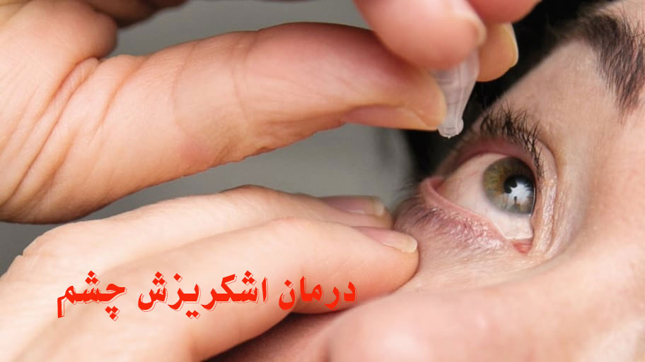 درمان اشک ریزش چشم
