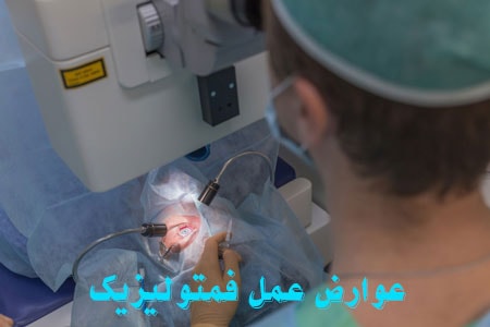 عوارض عمل فمتو لیزیک