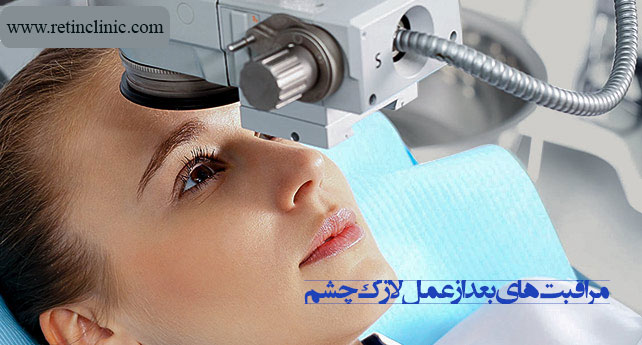 مراقبت‌های بعد از عمل لازک چشم