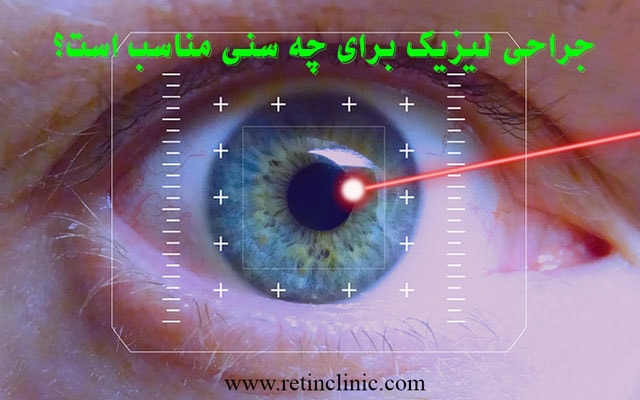 جراحی لیزیک برای چه سنی مناسب است؟