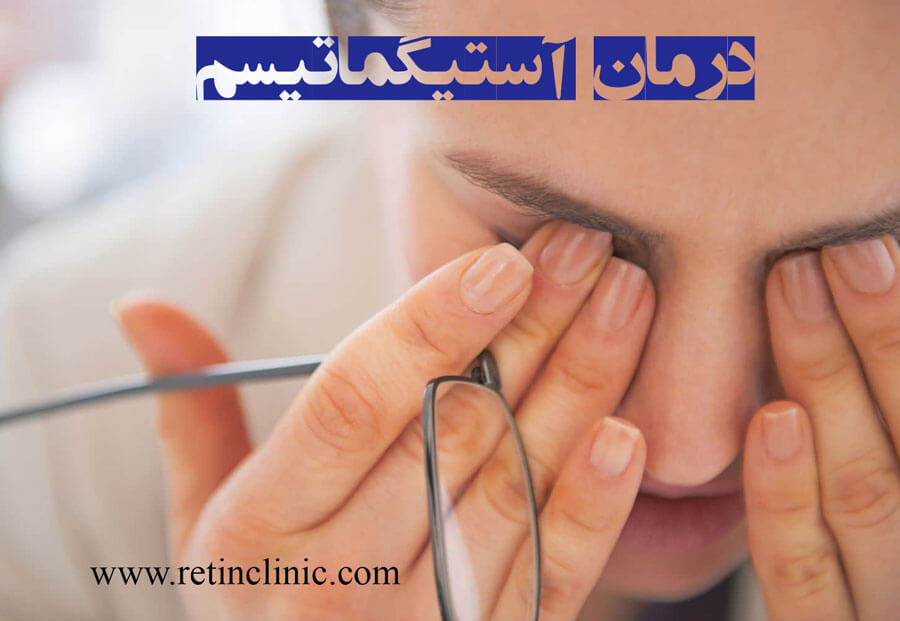 آستیگماتیسم چشم