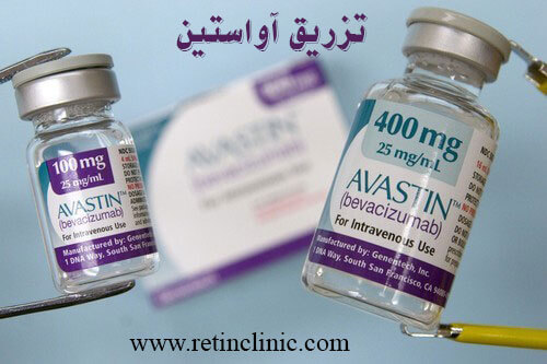 تزریق آواستین