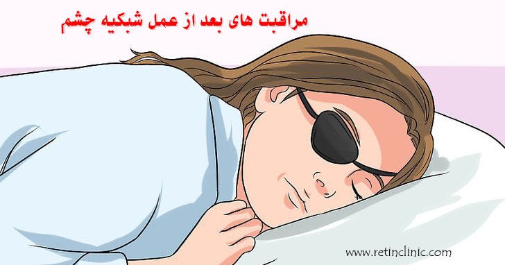مراقبتهای بعد از عمل جراحی شبکیه چشم