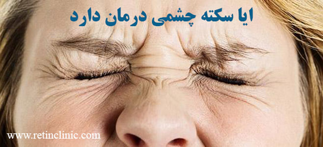 ايا سكته چشمي درمان دارد