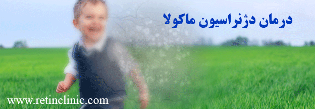 درمان دژنراسیون ماکولا