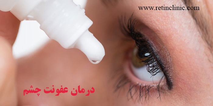 درمان عفونت چشم