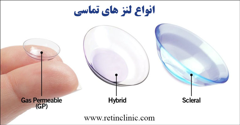 انواع لنز های تماسی