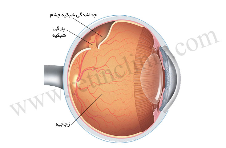 شبکیه چشم